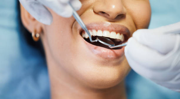 Best Teeth Whitening  in Berwick, LA