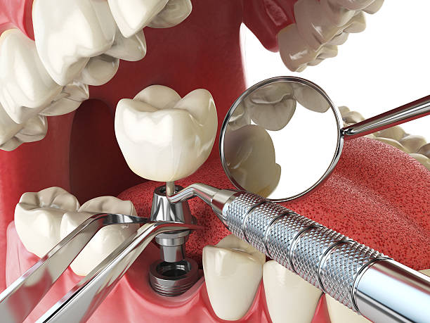 Best Tooth Pain Emergency Relief  in Berwick, LA